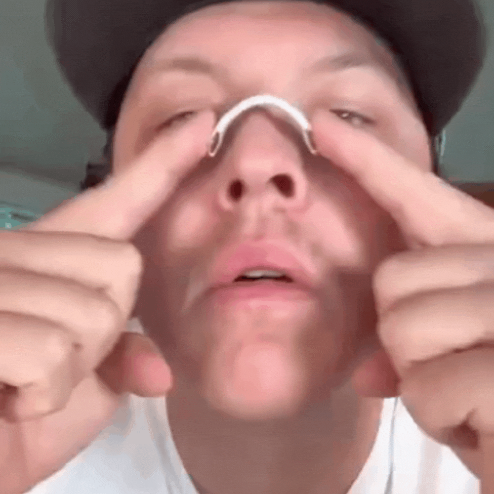 SNUZE™-Breathing Nasal Dilator