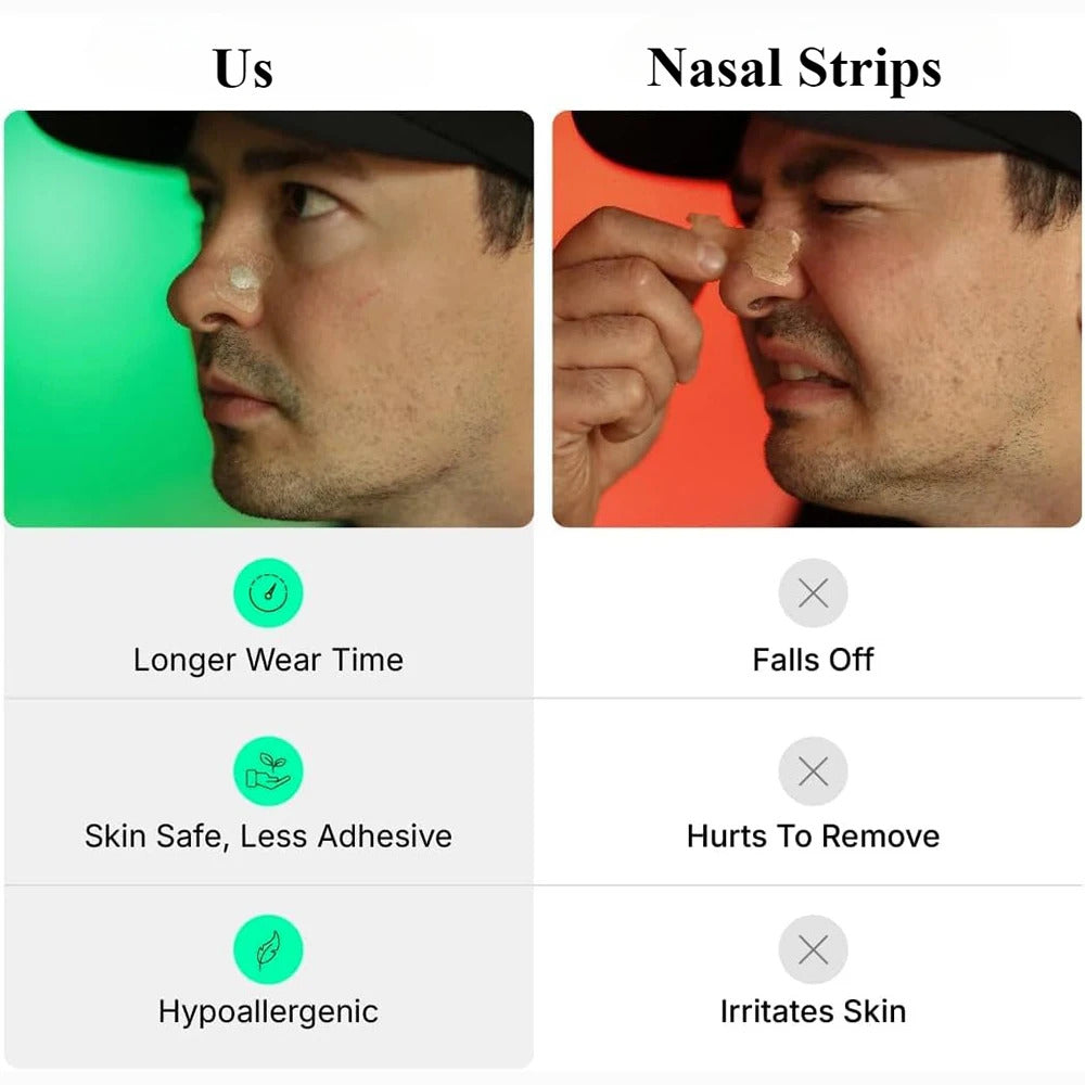 200/100/50/10 extra nose strips